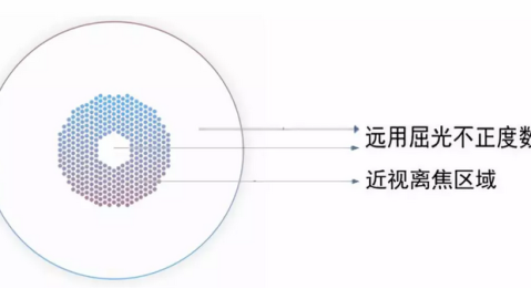 多点离焦 vs 周边离焦，一个家长的7天认知突围实验