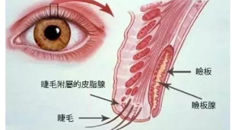 我来搜索关于睑板腺按摩与视力矫正的相关资料