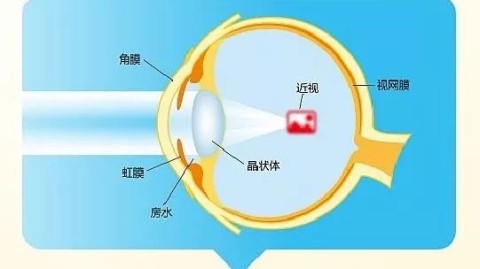 你以为，只要来回切换视线，让眼睛在远方和近处之间反复横跳，就能把模糊的世界重新看清楚，甚至从此告别眼镜