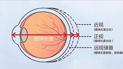 经常有家长朋友和成年近视患者问我，去医院做慢散瞳矫正视力验光，到底需要几天时间？这个问题其实没有绝对的统一答案，因为所需时间主要取决于使用的散瞳药物类型以及个体眼睛的调节力恢复速度