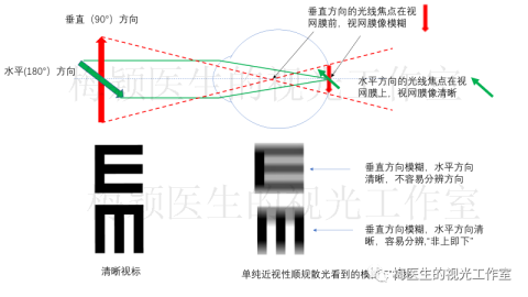 在眼科临床和视光学中，逆规散光比顺规散光矫正更难，且患者的主观不适感往往更强