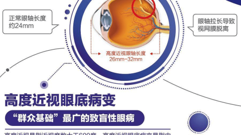 低浓度阿托品控制近视是近年来眼科领域的研究热点，已有较多临床证据支持其有效性，但效果因人而异，需理性看待