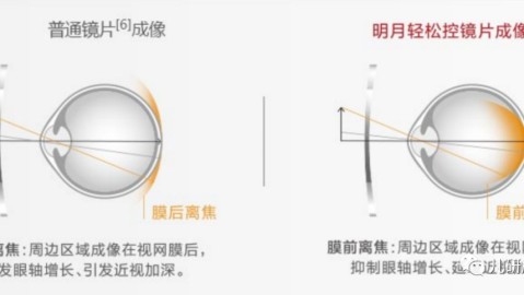 变色近视眼镜值得买吗？基变镜片日常使用优劣全解析